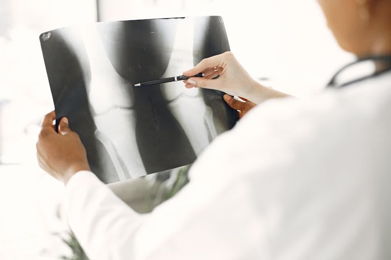 A medical professional closely examines a leg X-ray, pointing out details with a pen.